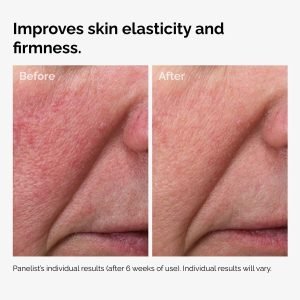 100pct-fermented-rose-hip-before-after-elasticity.jpg