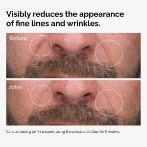 100pct-fermented-rose-hip-before-after-wrinkles.jpg