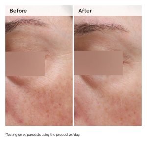 2024-08-23-ORD-Nia-5pct-Face-Body-B-A-Elasticity-Global-02-1x1-1.jpg