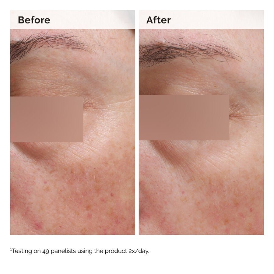 2024-08-23-ORD-Nia-5pct-Face-Body-B-A-Elasticity-Global-02-1x1-1.jpg