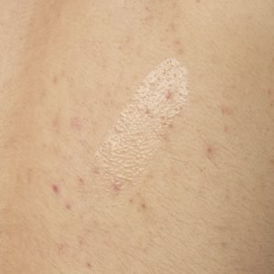 ORD-salicylic-acid-05-body-240ml-application.jpg