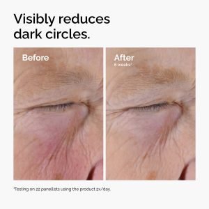 ord-caffeine-solution-egcg-dark-circles-before-after.jpg
