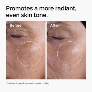 ord-glycolic-before-after-radiance.jpg