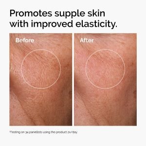 ord-hyaluronic-acid-2pct-b5-hydrating-serum-before-after-elasticity.jpg