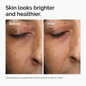 ord-mars-before-after-healthy.jpg