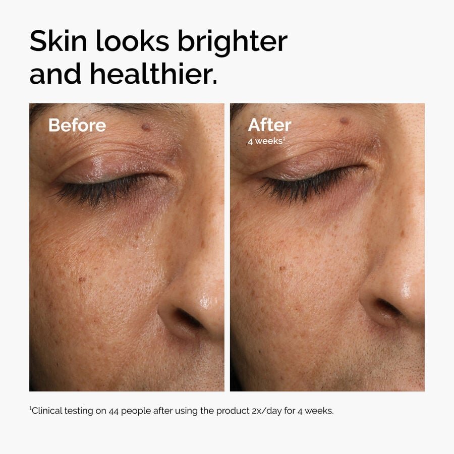 ord-mars-before-after-healthy.jpg