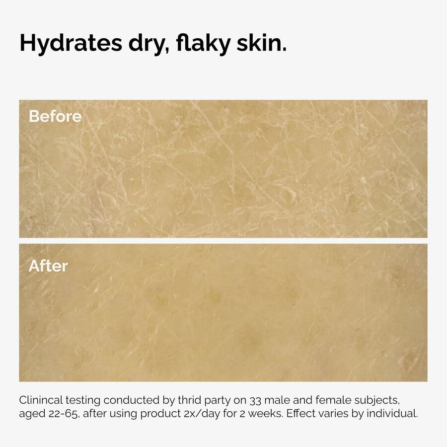 ord-natural-moisturizing-factors-inulin-body-before-after-graphic-02.jpg