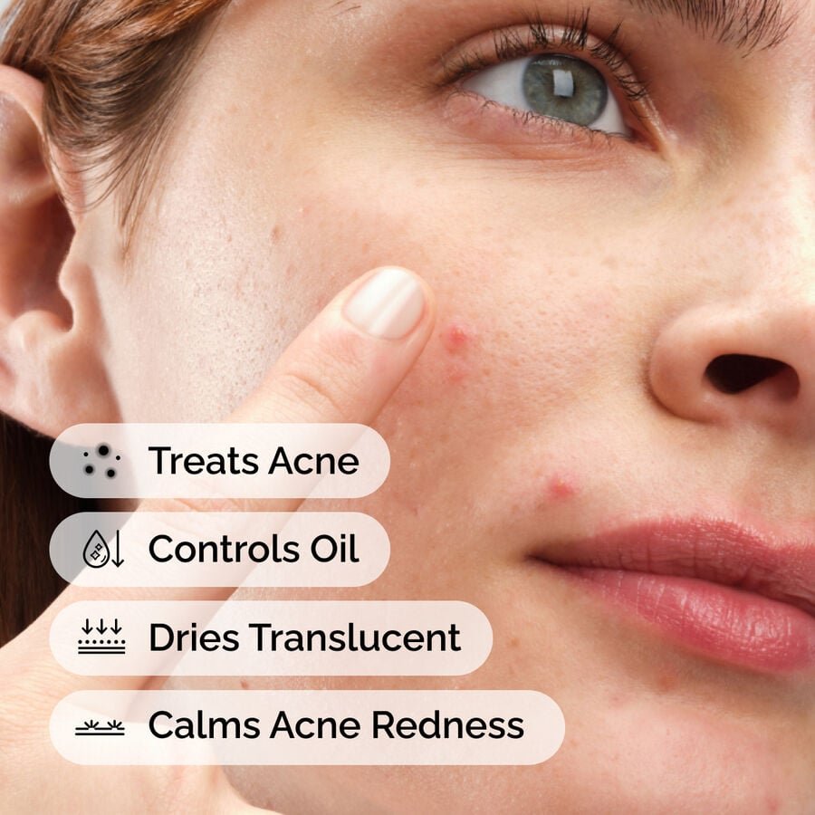 ord-sulfur-10pct-powder-to-cream-concentrate-model-application-with-benefits-acne.jpg